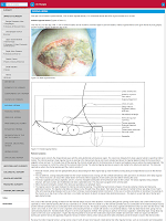 Surgery UCT screenshot 4