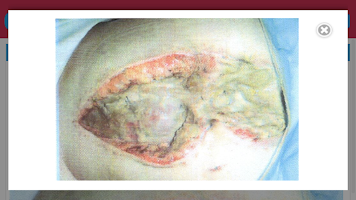Surgery UCT screenshot 2