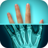 Amazing X-Ray