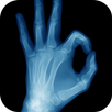 Best X-Ray FREE APK