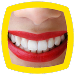 Teeth Whitening