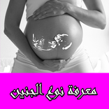 معرفة نوع الجنين
