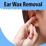 ”Ear Wax Removal