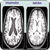 Schizophrenia Heilung APK