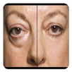 Eye Bags Guide APK
