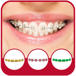 Braces Camera Effects