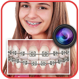Braces Teeth Booth