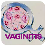 Vaginitis Disease