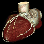 CARDIAC CT TECHNIQUE
