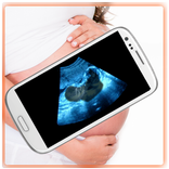 Ultrasound Scanner (Prank)