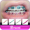 Braces Colors Beauty APK
