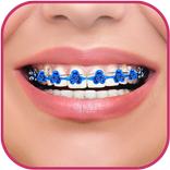 Braces Teeth Beauty photos
