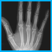 Xray APK