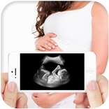 Ultra Sound Scanner Prank