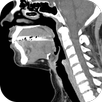CT Neck APK