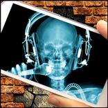 Radiographie Mur (Blague)