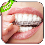 teeth whitening secrets tips