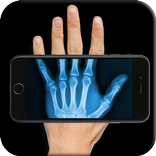 ”X-Ray body scan (prank)
