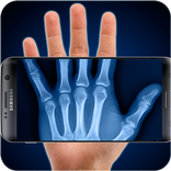 Scan met X-ray (simulatie)
