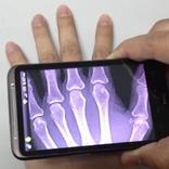 Xray Scanner