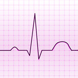 Electrocardiograma ECG Tipos