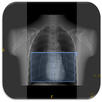 CT Scan Technique APK