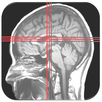 MRI PLANNING AND PATHOLOGY ANATOMY APK