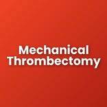 Thrombectomy