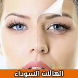 APK الهالات السوداء تحت العين