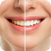 Dental Care Tips APK