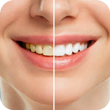 Dental Care Tips