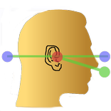 Smart Facebow