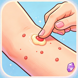 Pimple Rush