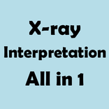 Medical X-Ray with 150+ cases