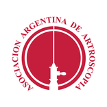 Artroscopía