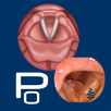 Polyps APK