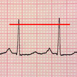 ECG Reader free