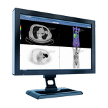 CT Imaging of PET MRI & SPECT