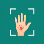 Rash Identifier: AI Skin Scan